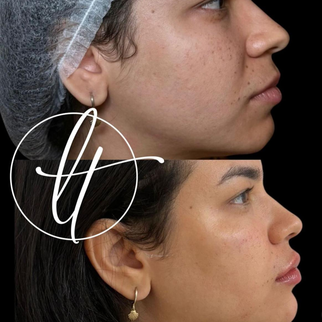 Especialista em harmonização facial (10)