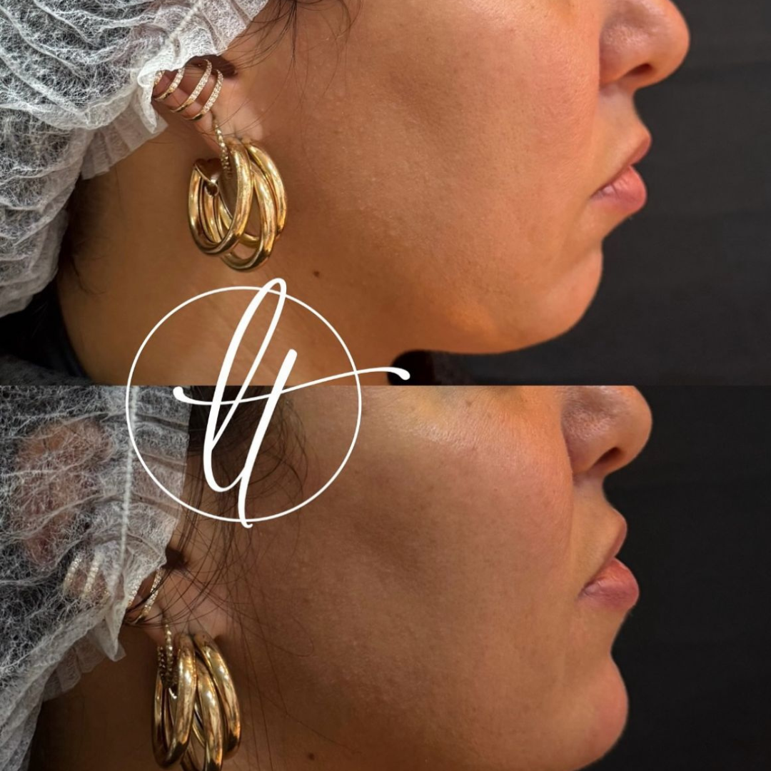 Especialista em harmonização facial (11)