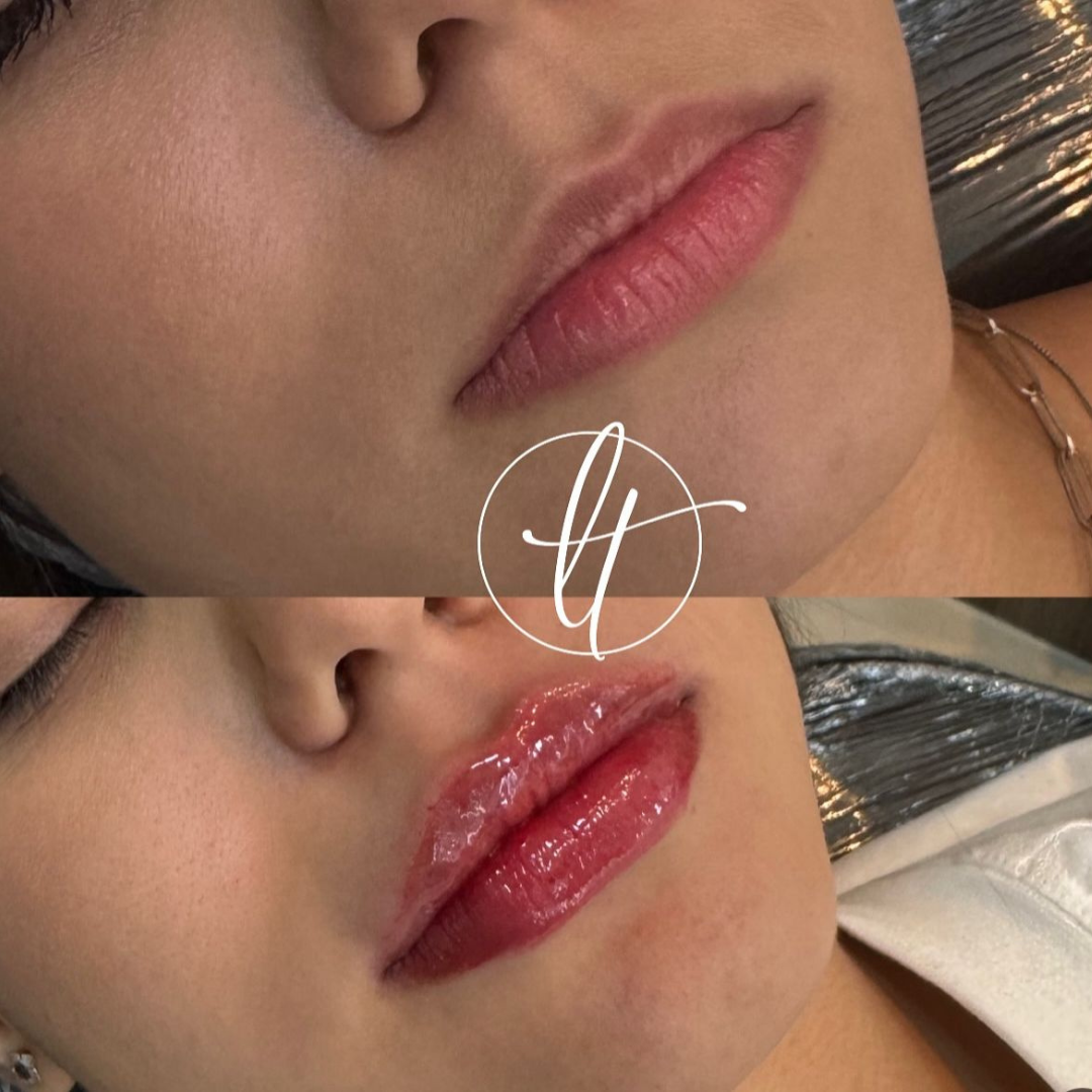 Especialista em harmonização facial (12)