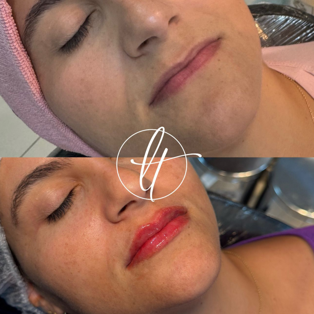 Especialista em harmonização facial (2)