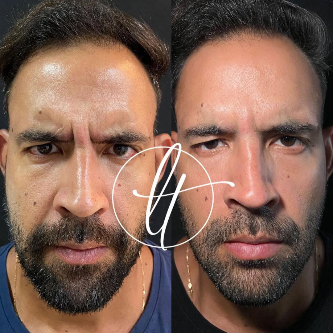 Especialista em harmonização facial (3)