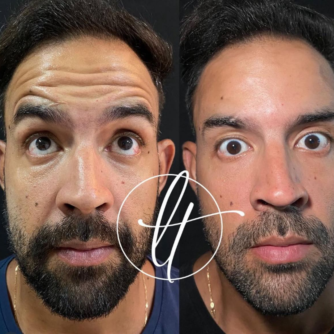 Especialista em harmonização facial (4)