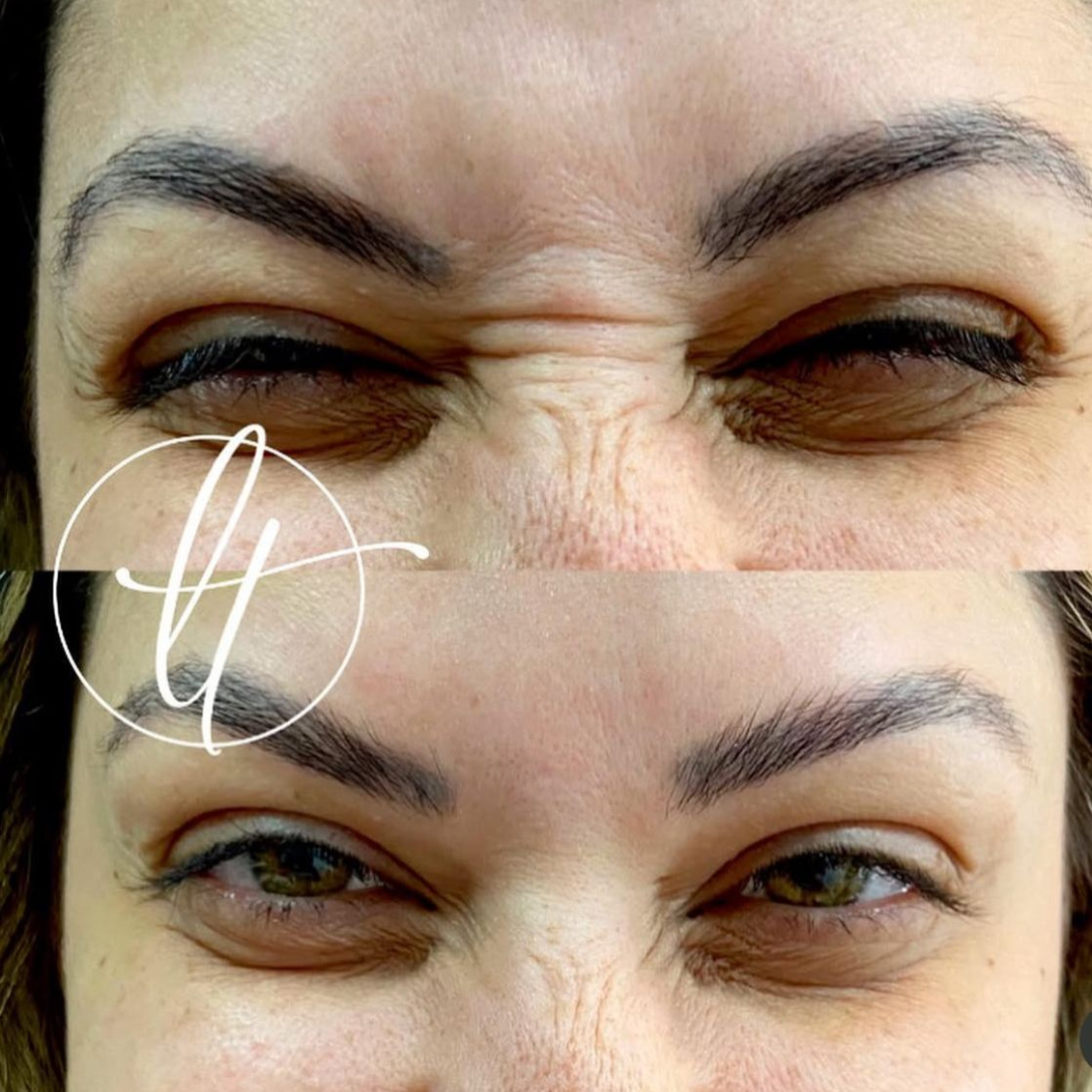 Especialista em harmonização facial (5)