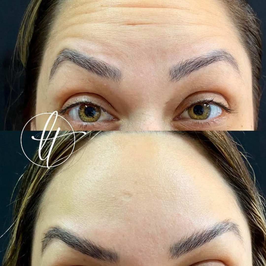 Especialista em harmonização facial (6)