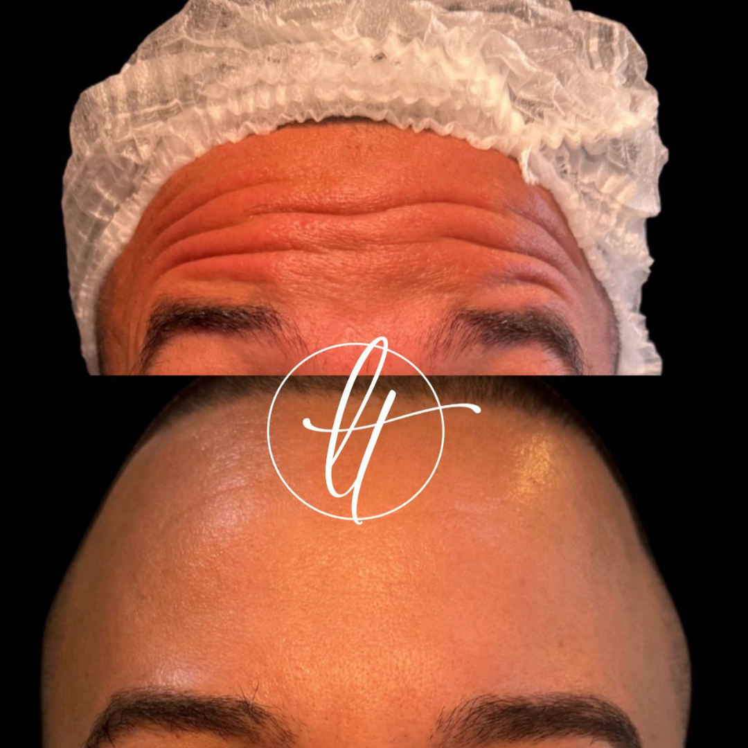 Especialista em harmonização facial (7)