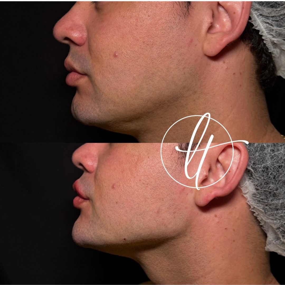 Especialista em harmonização facial (8)