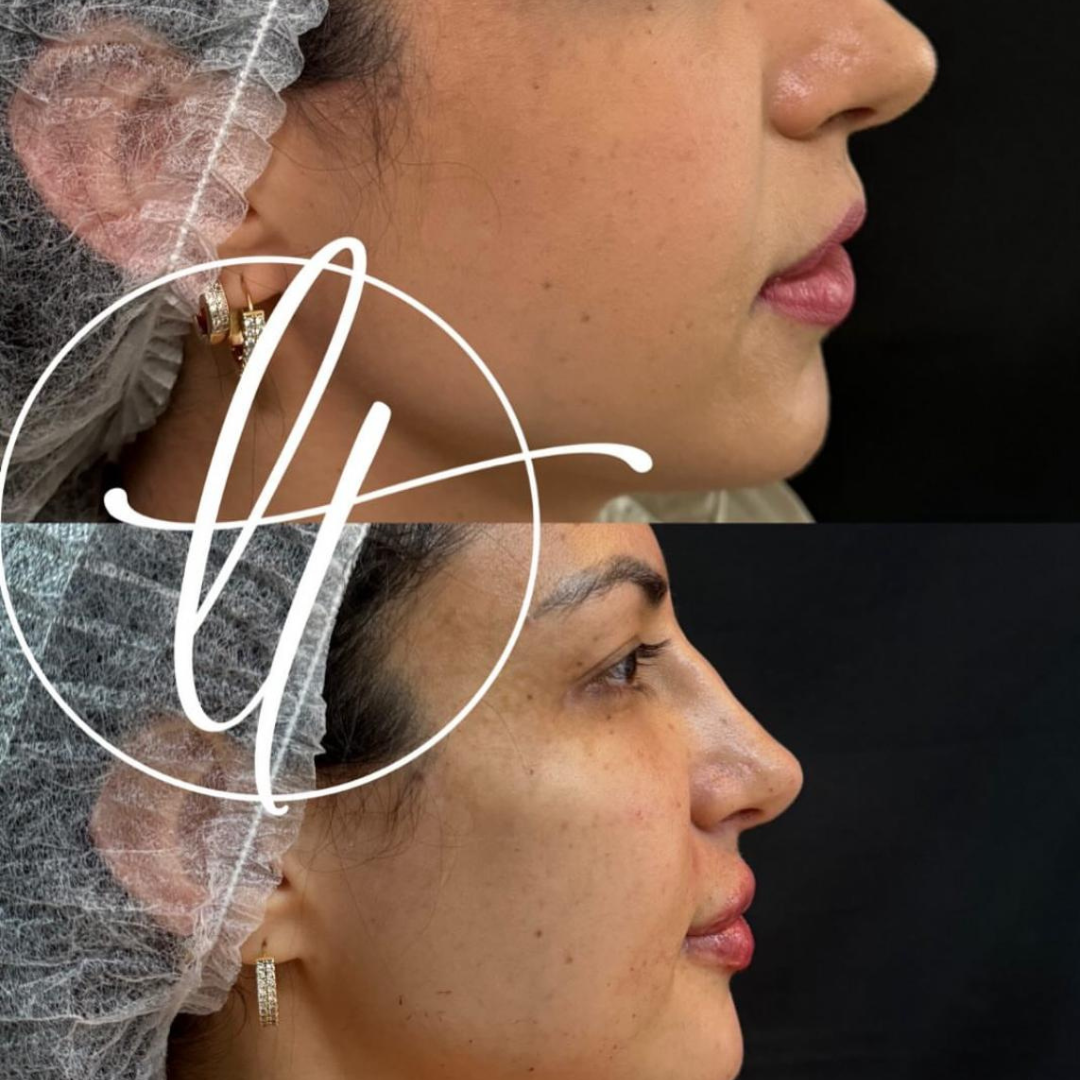 Especialista em harmonização facial (9)